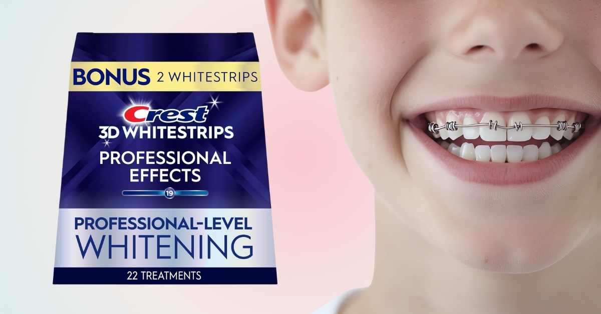 Crest 3D Whitestrips Professional Effects: Your Complete Guide to Professional-Grade Teeth Whitening at Home